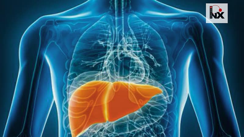 Silent Liver Disease Hits Millions in India